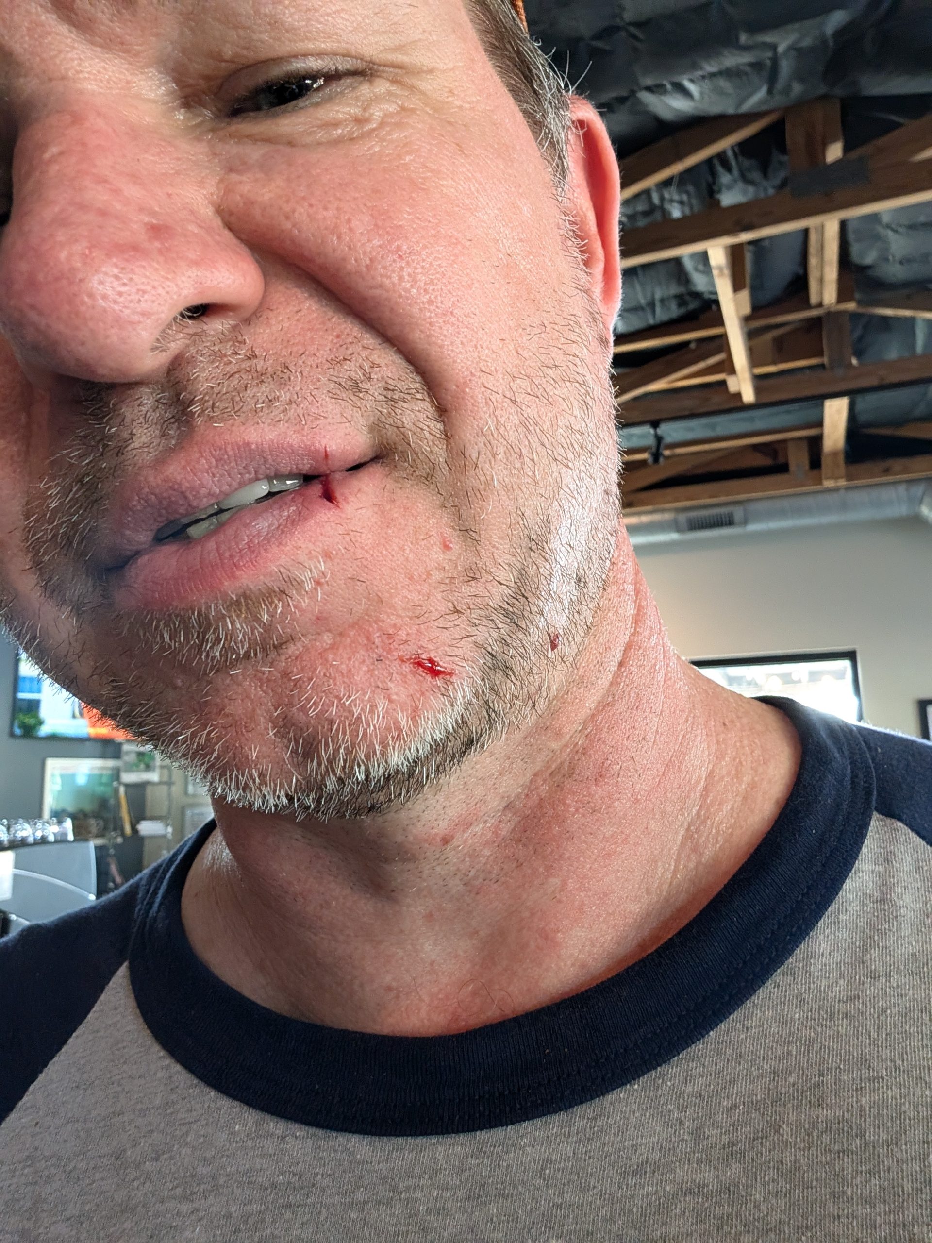 The Injury